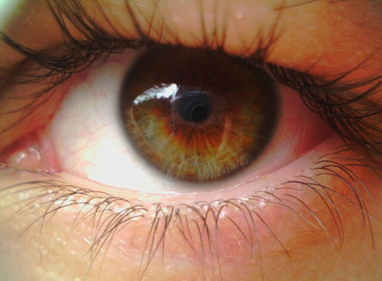 глаз близко