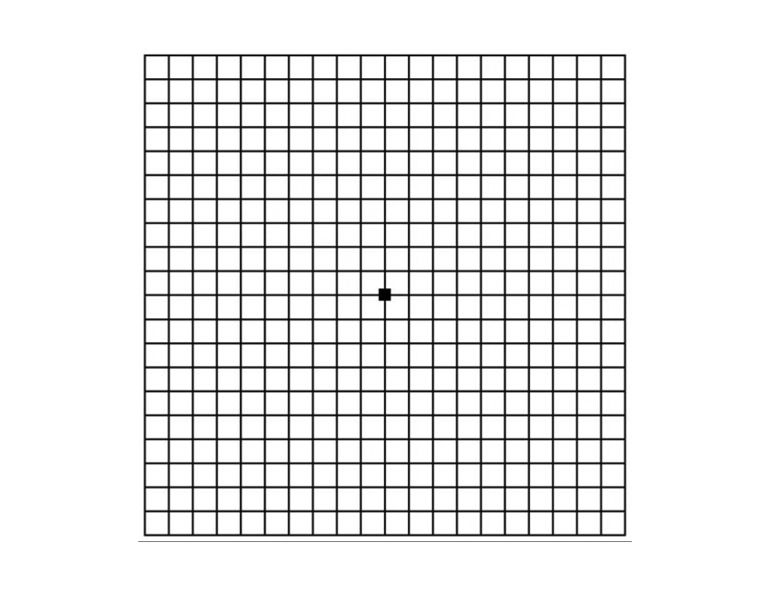 тест Амслера