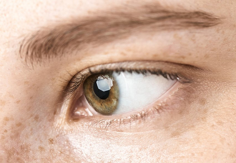 желтый глаз