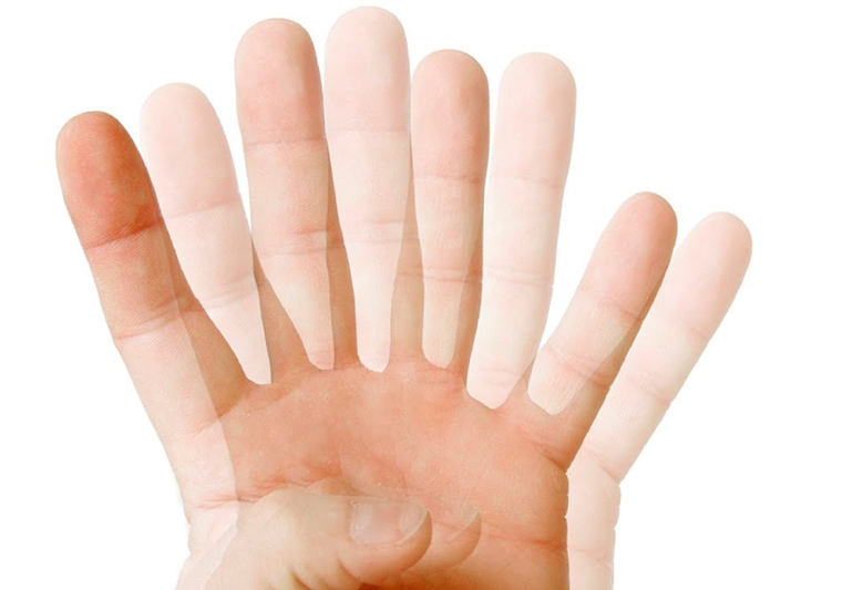 палцы двоятся