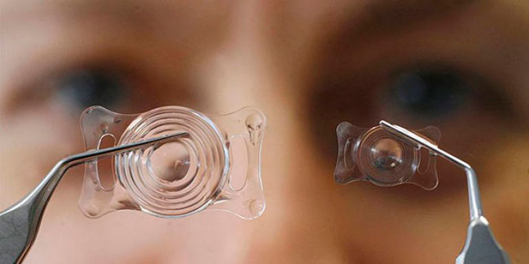 Операция по замене хрусталика