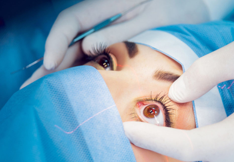 лазерная коррекция зрения