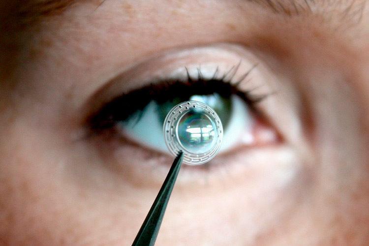 кератопротезирование