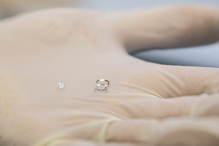 кератопротезирование сквозной имплант