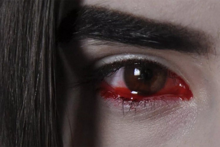 кровавые слезы