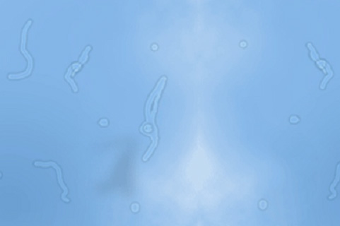 мушки перед глазами