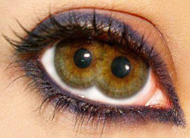 двойной зрачок